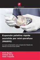 Kirti Banka, Ashish Garg, Amit Tripathi - Expansão palatina rápida assistida por mini-parafuso (MARPE)