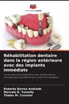 Roberta Barros Andrade, Thales M. Cruvinel, Marcelo B. Toniollo - Réhabilitation dentaire dans la région antérieure avec des implants immédiats