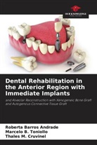 Roberta Barros Andrade, Thales M. Cruvinel, Marcelo B. Toniollo - Dental Rehabilitation in the Anterior Region with Immediate Implants