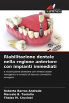 Roberta Barros Andrade, Thales M. Cruvinel, Marcelo B. Toniollo - Riabilitazione dentale nella regione anteriore con impianti immediati