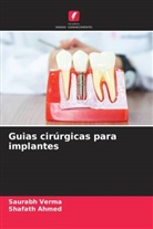 Shafath Ahmed, Saurabh Verma - Guias cirúrgicas para implantes