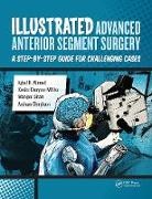 Iqbal Ahmed, Iqbal K Moller Ahmed, Iqbal K. Ahmed, Iqbal Moller Ahmed, Xavier Möller, Xavier Campos Möller... - Illustrated Advanced Anterior Segment Surgery
