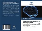 Anju Devi Loukham - Intrakranielle Läsionen in der Multisliced-Computertomographie (64 Schichten)