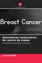 Lynda Aoudia - Assinaturas moleculares do cancro da mama