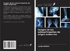 Lynda Aoudia - Imagen de las osteoartropatías de origen endocrino