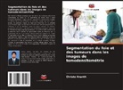 Christo Ananth - Segmentation du foie et des tumeurs dans les images de tomodensitométrie