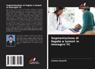 Christo Ananth - Segmentazione di fegato e tumori in immagini TC