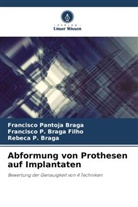 Francisco P Braga Filho, Rebeca P. Braga, Francisco P. Braga Filho, Francisco Pantoja Braga - Abformung von Prothesen auf Implantaten