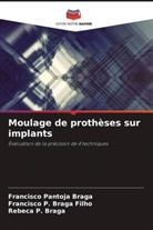 Rebeca P. Braga, Francisco P. Braga Filho, Francisco Pantoja Braga - Moulage de prothèses sur implants
