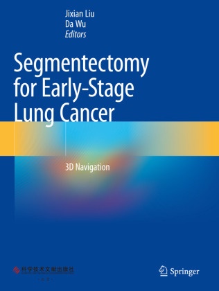 Jixian Liu, Wu, Da Wu - Segmentectomy for Early-Stage Lung Cancer 3D Navigation