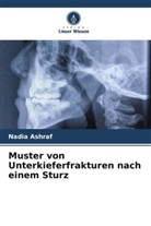Nadia Ashraf - Muster von Unterkieferfrakturen nach einem Sturz