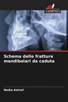 Nadia Ashraf - Schema delle fratture mandibolari da caduta