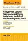Giuseppe Bagliani, Luigi Padeletti, Padeletti Luigi - Clinical Arrhythmias: Bradicardias, Complex Tachycardias and Particular Situations: Part II, An Issue of Cardiac Electrophysiology Clinics: Volume 10-2