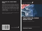 Shokhrukh Yusupov - FRACTURAS DEL HUESO MEDIO FACIAL