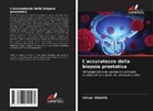 Intisar Ghleilib - L'accuratezza della biopsia prostatica