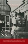 Allen M Hornblum, Hornblum Allen M. - Acres of Skin