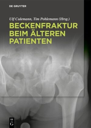 Ulf Culemann, Pohlemann, Tim Pohlemann - Beckenfraktur beim älteren Patienten