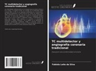 Fabíola Leite da Silva - TC multidetector y angiografía coronaria tradicional