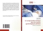 Mohamed Frikha, Mariem Nouira, Nesrine Souayeh - Le curage lombo-aortique dans les cancers gynécologiques pelviens
