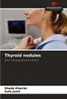 Safa Jemli, Ghada Kharrat - Thyroid nodules