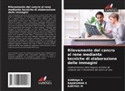 Karthic M, Subraja R, Rajakumar S - Rilevamento del cancro al rene mediante tecniche di elaborazione delle immagini