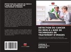 Karthic M, Subraja R, Rajakumar S - DÉTECTION DU CANCER DU REIN À L'AIDE DE TECHNIQUES DE TRAITEMENT D'IMAGES