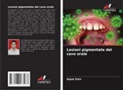 Dipak Patil - Lesioni pigmentate del cavo orale