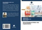 Abhijit Deshpande, Ankita Kale, Virsen Patil - Verschiedene Arten von Implantaten