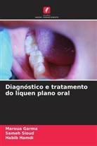 Maroua Garma, Habib Hamdi, Sameh Sioud - Diagnóstico e tratamento do líquen plano oral