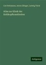Anton Elfinger, Carl Heitzmann, Ludwig Türck - Atlas zur Klinik der Kehlkopfkrankheiten