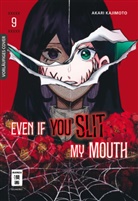Akari Kajimoto - Even if you slit my Mouth 09