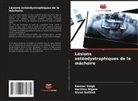 Haritma Nigam, Sivan Sathish, Gaurav Singh - Lésions ostéodystrophiques de la mâchoire