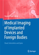 Daniela Kildal - Medical Imaging of Implanted Devices and Foreign Bodies