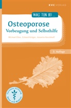 Michael Elies, Annette Kerckhoff, Eckard Krüger - Osteoporose
