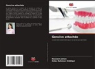 Naseem Jahan, Zeba Rahman Siddiqui - Gencive attachée
