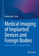 Daniela Kildal - Medical Imaging of Implanted Devices and Foreign Bodies