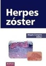 Magda Campins - Herpes zóster