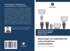 Bru Costa, Bruno Costa, Dalva Cruz Laganá, Piero Rocha Zanardi - Spannungen um Implantate bei unterschiedlichen Insertionshöhen