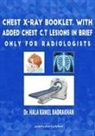 Hala Kamel Badrakhan - Chest X-Ray Booklet, with added Chest C.T Lesions in brief Only for Radiologists