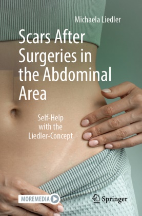 Michaela Liedler - Scars After Surgeries in the Abdominal Area - Self-Help with the Liedler-Concept