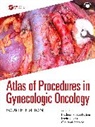 Nadeem R. (Memorial Sloan-Kettering Ca Abu-Rustum, Abu-Rustum Nadeem R., David Cibula, Giovanni Scambia - Atlas of Procedures in Gynecologic Oncology