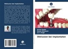 Roma Goswami, Richa Gupta, S P Singh, S. P. Singh - Okklusion bei Implantaten