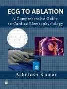 Ashutosh Kumar - ECG TO ABLATION A COMPREHENSIVE GUIDE TO CARDIAC ELECTROPHYSIOLOGY