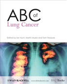 Ian Hunt, Ian (Guy''''s Hospital Hunt, Ian Muers Hunt, Martin M. Muers, Tom Treasure, Ian Hunt... - Abc of Lung Cancer