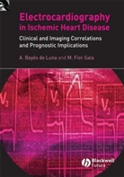 A. Bayes de Luna, Antoni Bayes De Luna, Antonio Bayes De Luna, Antonio Fiol-Sala Bayes De Luna, Anton Bayés de Luna, Antoni Bayés de Luna... - Electrocardiography in Ischemic Heart Disease