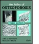 Michael S Marsh, Michael S. Marsh, Michael S. (King's College Hospital Marsh, Marsh Michael S., John C Stevenson, John C. Stevenson... - Atlas of Osteoporosis
