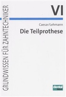 H Han Caesar, Hans Caesar, Hans H Caesar, Hans H. Caesar, Klaus M Lehmann, Klaus M (Prof. Dr.) Lehmann... - Grundwissen für Zahntechniker - 6: Die Teilprothese