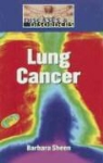 Barbara Sheen - Lung Cancer