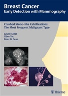 Peter B Dean, Peter B. Dean, Laszl Tabar, Laszlo Tabar, Tibo Tot, Tibor Tot... - Breast Cancer: Crushed Stone-like Calcifications: the Most Frequent Malignant Type