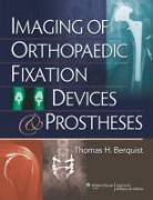 Thomas H. Berquist, BERQUIST THOMAS H - Imaging of Orthopaedic Fixation Devices and Prostheses